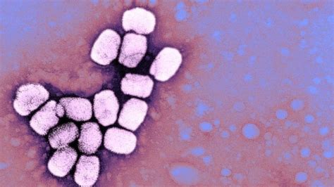 Viruela ¿por Qué Todavía Se Guardan Dos Muestras Del Virus Que Produce