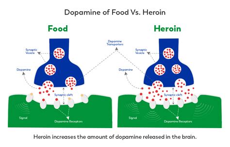 How Does Addiction Affect The Brain Ask Our Doctors By Journeypure