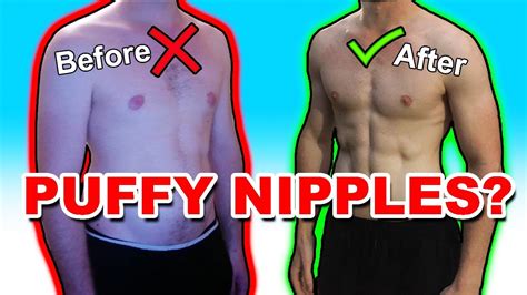 How To Get Rid Of Man Nipples Phaserepeat