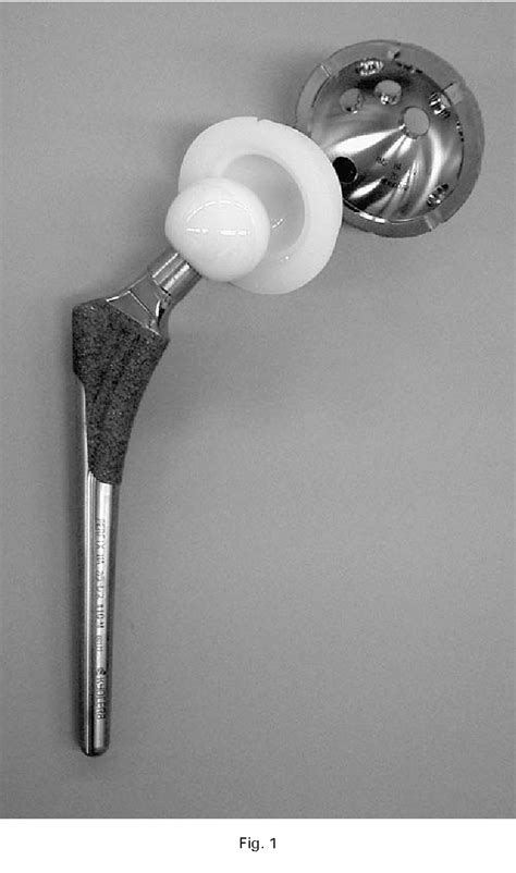 Figure 1 From Alumina Ceramic On Ceramic Total Hip Replacement With A