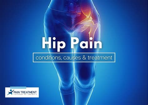 An Overview Of Hip Pain Conditions Causes And Treatment Ptcoa