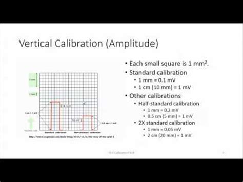 The national heart, lung, and blood institute describes ekgs for use in diagnosing heart blockage. ECG Calibration - YouTube