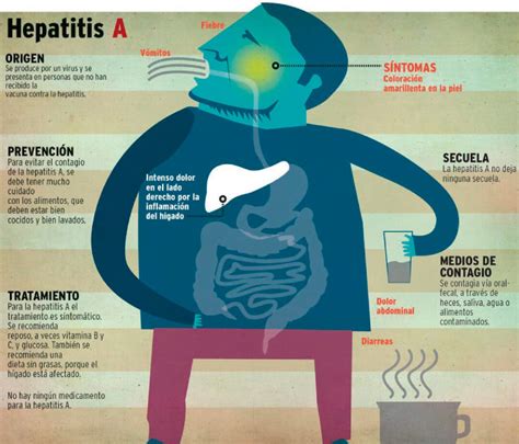 Hepatitis A causas síntomas y tratamiento Meditip
