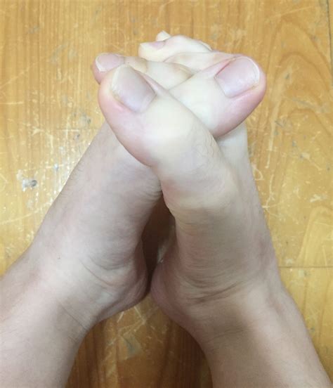A Quoi Sert Le Petit Orteil - Franchement, avez-vous déjà vu des doigts de pieds comme ça