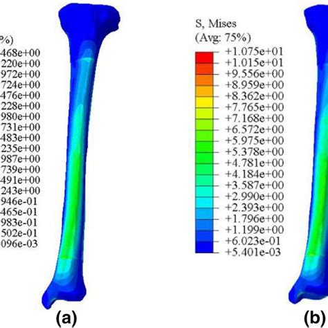 Stress Distribution Diagrams Of The Tibial Fracture Upper Surface Fixed