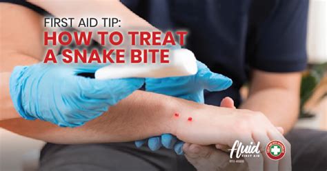 Fluid First Aid First Aid Tip How To Treat A Snake Bite