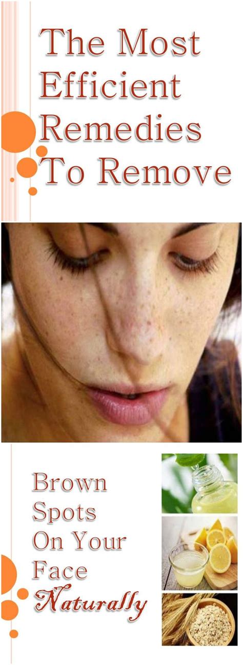 The Most Efficient Remedies To Remove Brown Spots On Your Face