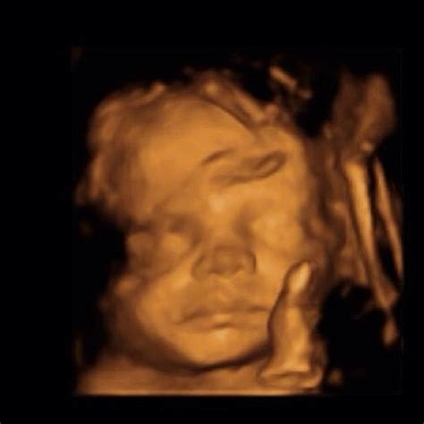 3d4d Sonogram Of Our Beautiful Baby Girl Harper Edd 104 Flickr