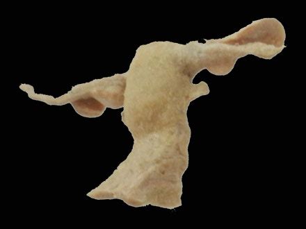 Female body shapes part 2 by rofelrolf on deviantart. human body parts plastinated specimens