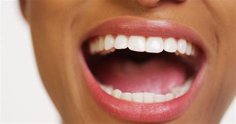 Word of mouth marketing is one of the most important types of marketing for most brands, products or services. The 9 Most Common Dental Problems: Mouth Sores | 6th Ave ...