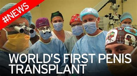 First Transplant Of Penis Took Place In The United States Aurora Cup