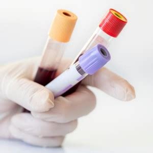 Os Exames de Sangue Mais Comuns Conheça os Testes Essenciais para a