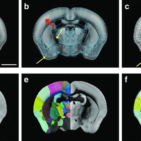 Pdf Enhanced And Unified Anatomical Labeling For A Common Mouse Brain