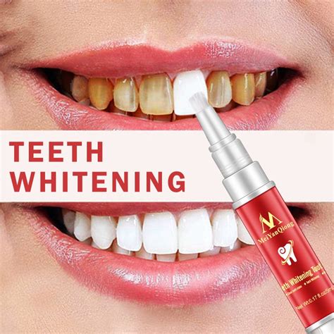 Pro Popular White Teeth Whitening Pen Teeth Gel Bleach Cleaning Oral