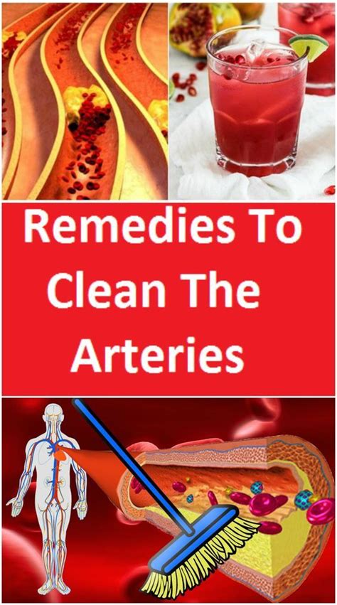 remedies to clean the arteries remedies healthy advice arteries