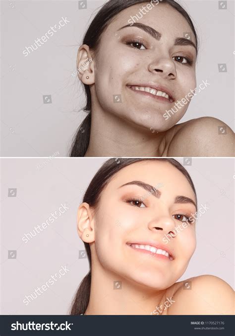 Health People Youth Beauty Concept Before Stock Photo 1170527176