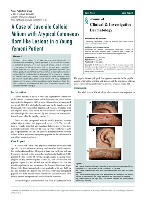 Pdf A Case Of Juvenile Colloid Milium With Atypical Cutaneous Horn