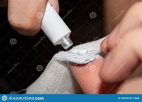 Closeup View Of Hands Squeezing Thermal Paste From A White Tube Onto A