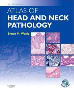 Atlas Of Head And Neck Pathology Nd Edition Original Pdf From