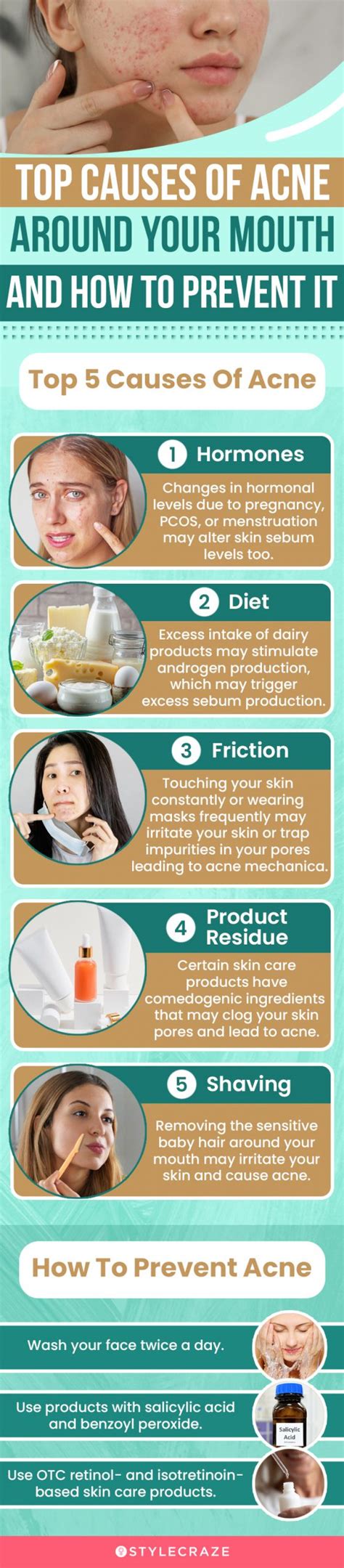 Types Of Acne Around The Mouth And How To Deal With Them