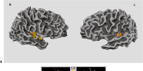 Figure 4 From Functional Fields In Human Auditory Cortex Revealed By