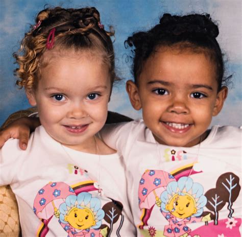 These Twins Will Make You Rethink Race Twins Racism Today Baby Face