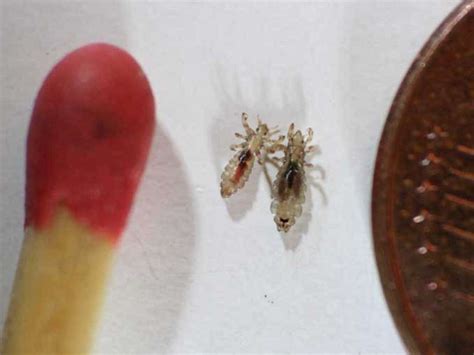 Pubic Lice Crabs Symptoms Risk Factors And Treatment