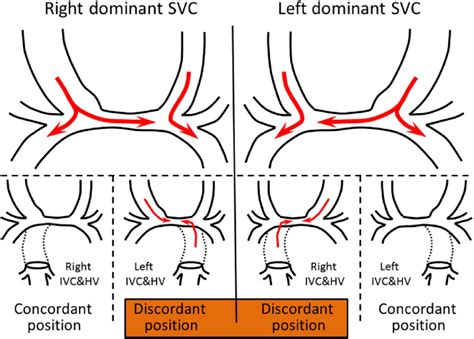 Definitions Of Concordantdiscordant Relationships Between The Dominant