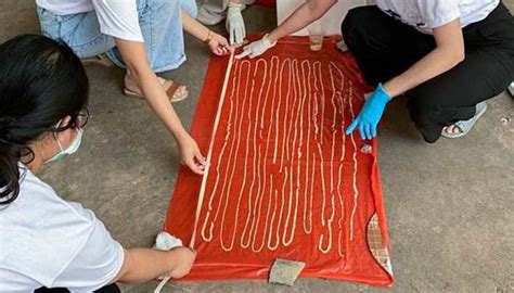 59 Foot Long Tapeworm Discovered Inside Thai Mans Intestines Viral News Zee News