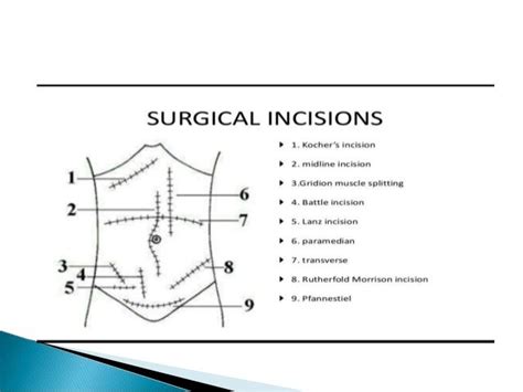 Abdominal Incisions