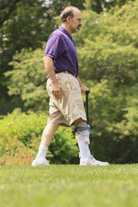 Man With Ankle Sprain Walking With Cane Stock Image F0124341 Science Photo Library