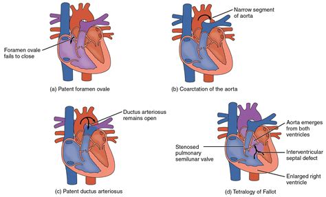 Heart Anatomy Anatomical Basis Of Injury