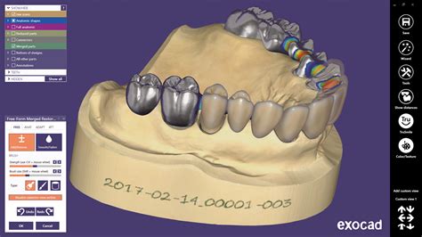Pearl Dental Software The Rise And Rise Of 3d