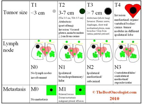 pdf detection and classification of lung cancer stages using image my xxx hot girl