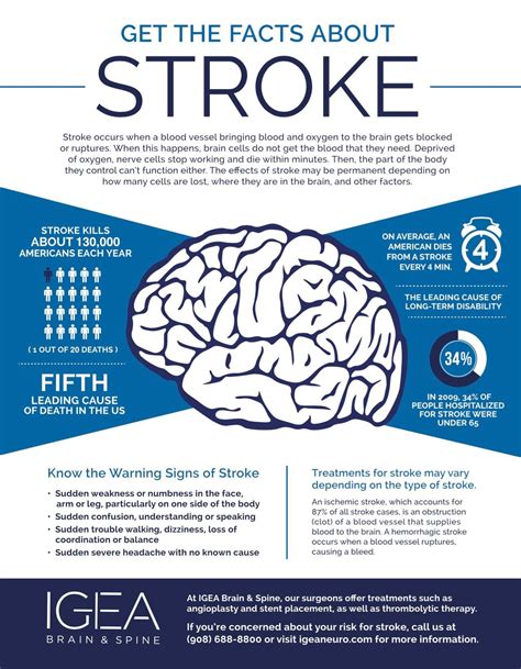 Igea Brain And Spine Infographic Get The Facts About Stroke