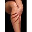 Calf Swelling  Doctor Answers On HealthTap