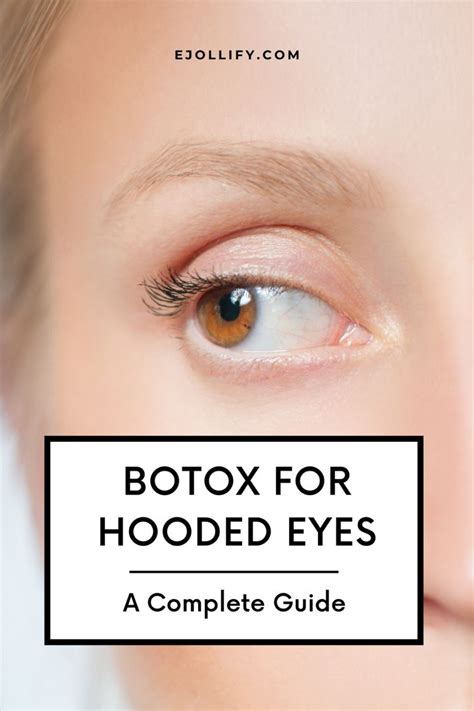 Botox For Hooded Eyes • A Complete Guide In 2021 Botox Brow Lift