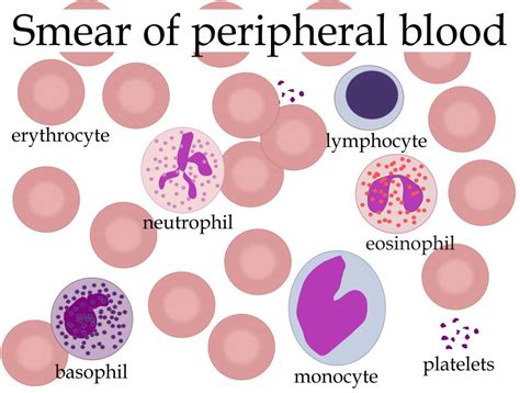 What Are Atypical Lymphocytes