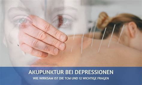 Akupunktur Bei Depressionen Funktioniert Das 12 Faqs