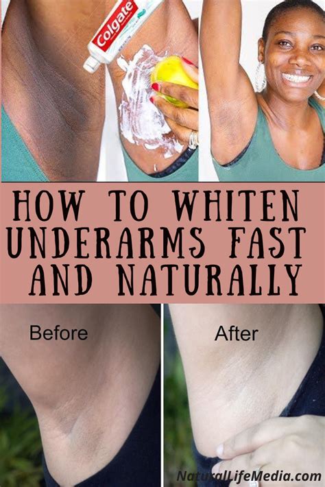 How To Whiten Underarms Fast And Naturally Natural Life Media