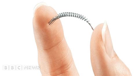 Women Reassured Over Safety Of Essure Birth Control Implant Bbc News