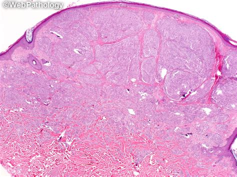 A Collection Of Surgical Pathology Images