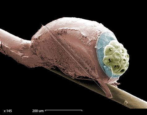 Sem Of A Head Lice Eggs