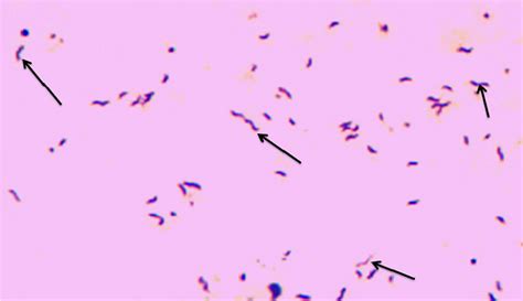 Campylobacter Stool Culture Stools Item
