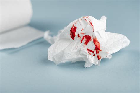 Hemorrhoids Treatment Health Problems Toilet Paper With The Blood Drops