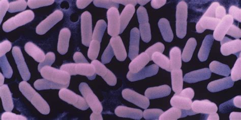 In most people, listeria infection symptoms and signs mainly include the common symptoms of food poisoning such as. Listeria | Food Poisoning Lawyers
