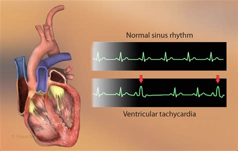 Health Condition Symptoms Causes Treatment And More