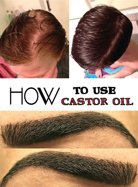 It can be the hairline or top of the scalp or maybe the sides. HOW TO USE CASTOR OIL #DailyFaceCare | Castor oil for hair ...