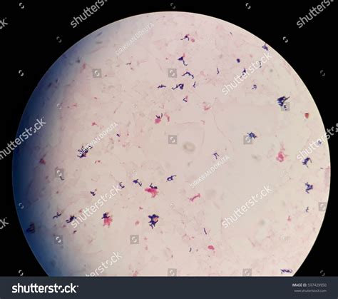 Smear Gram Positive Bacilli Chinese Letters Foto Stock 597429950