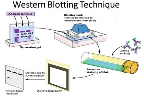 Western Blot Test Procedure And Purpose Of Western Blot